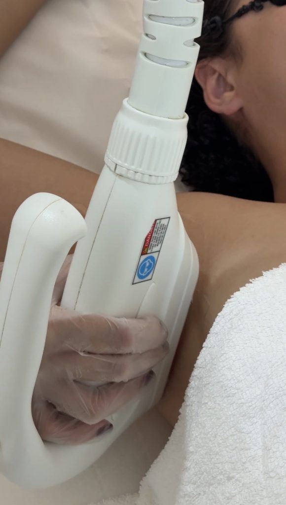 épilation laser 100% laser